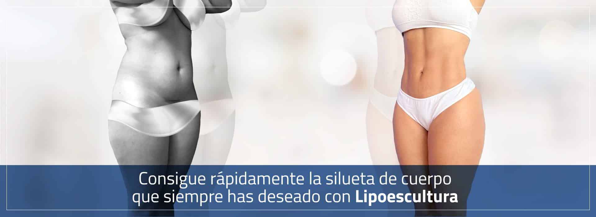 Lipoescultura Colombia