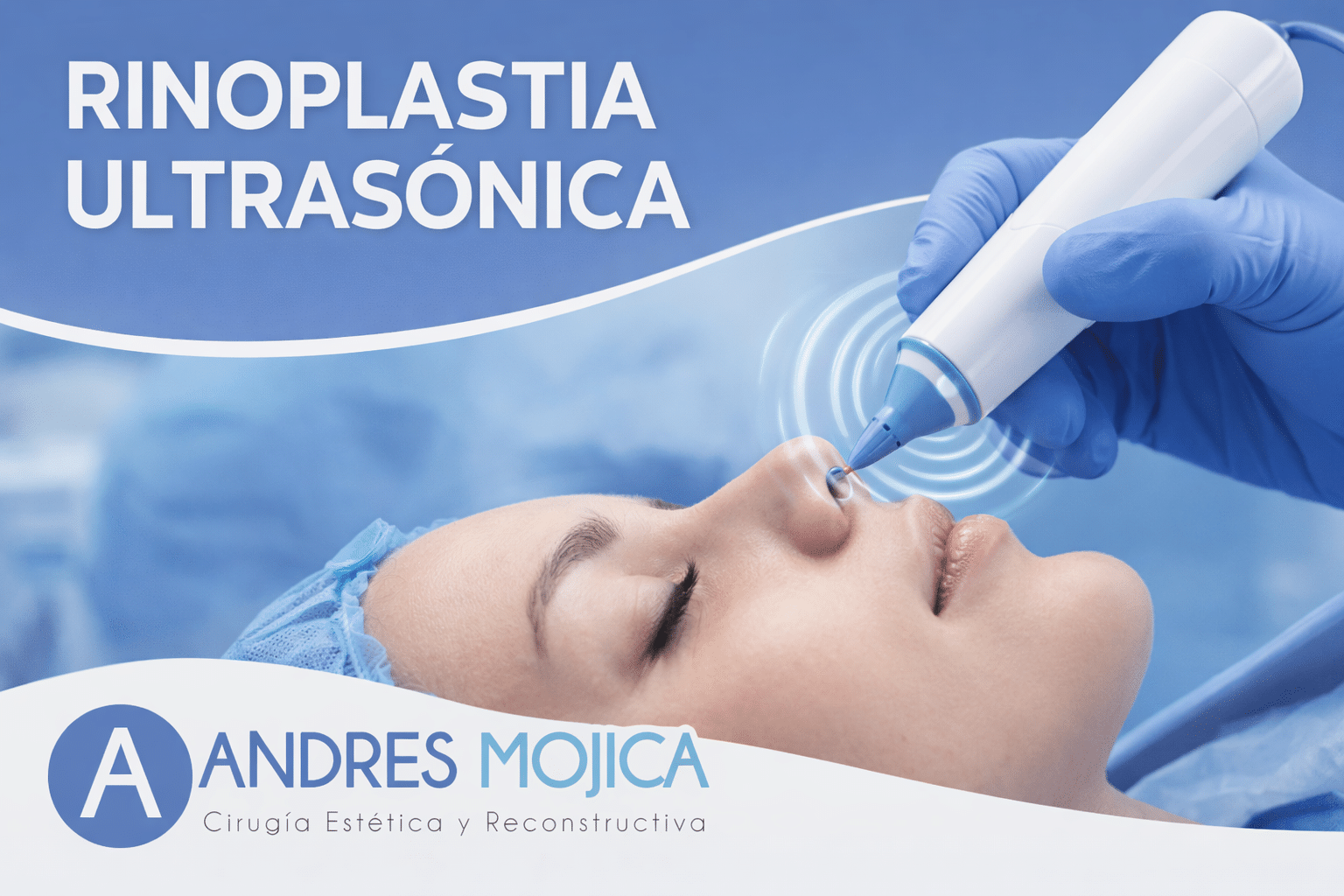 Rinoplastia Ultrasónica