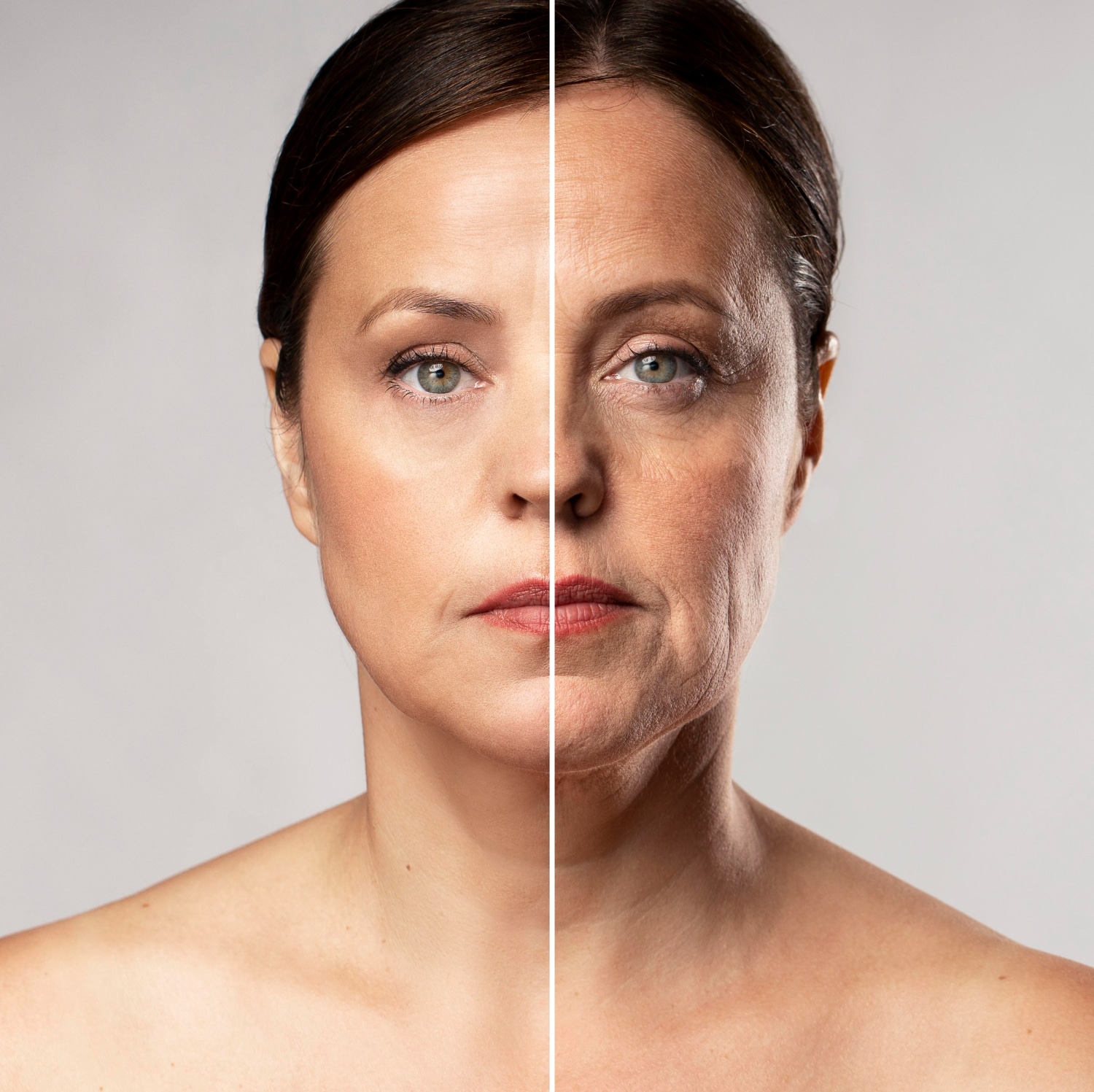 lipoinyeccion facial​